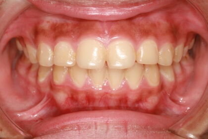 So und viel schlimmer!